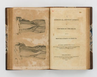 Surgical Observations, containing a Classification of Tumours, with Cases to illustrate the History of Each Species; an Account of Diseases which strikingly resemble the Venereal Disease; and Various Cases illustrative of Different Surgical Subjects