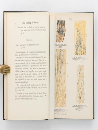 The Healing of Nerves