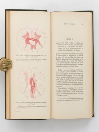 Diseases of the Spinal Cord