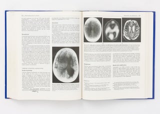 Craniomaxillofacial Trauma. A System of Multidisciplinary Management by Members of the Australian Craniofacial Unit