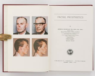 Facial Prosthetics